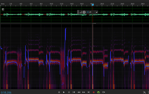 さらに別エディタ